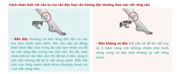 Rắn hổ bò vào nhà cắn tay người dân, cảnh báo mùa rắn cắn đang đến-1