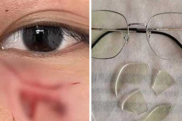 Đấm học sinh khâu 16 mũi, thầy giáo ở Trung Quốc bị sa thải-2