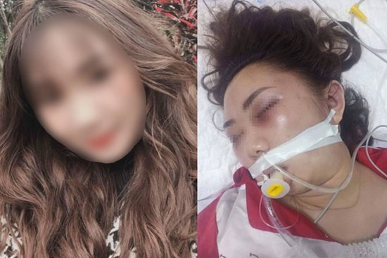 Nam thanh niên lên tiếng khi bị tố cáo đánh bạn gái 22 tuổi