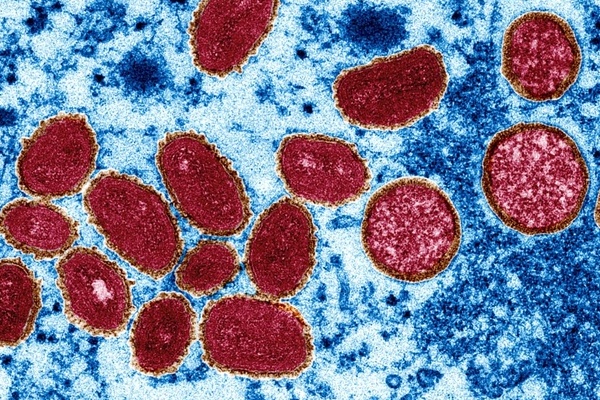 WHO phát hiện virus gây bệnh đậu mùa khỉ trong tinh dịch của bệnh nhân-2
