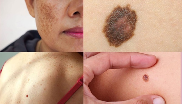 Bất ngờ khi 1 nghiên cứu tại Mỹ chỉ ra ăn nhiều cá gây ung thư, hóa ra có nguyên nhân tiềm ẩn ít ai biết-2