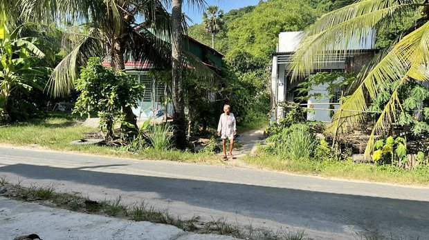 Bi kịch cuộc đời người đàn ông bị bướu che kín mặt và nỗi nhớ thương người vợ quá cố-3