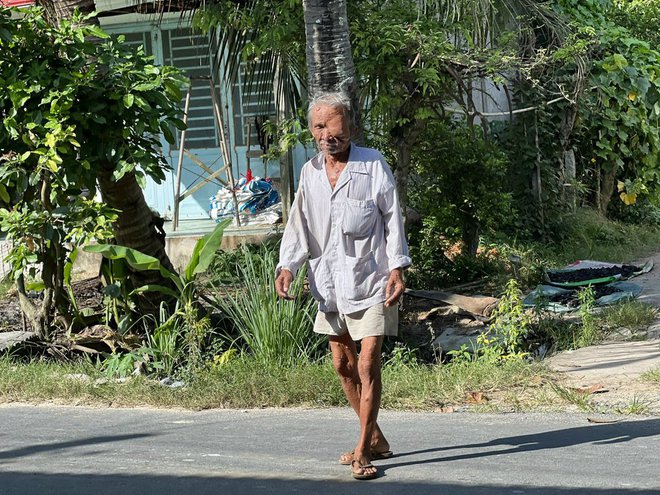 Bi kịch cuộc đời người đàn ông bị bướu che kín mặt và nỗi nhớ thương người vợ quá cố-5