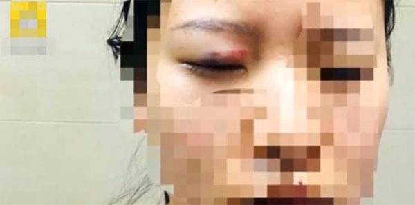 Xin tiền không được, gã đàn ông cầm nạng phang tới tấp vào cửa kính ôtô, hành động sau đó còn đáng sợ hơn-3