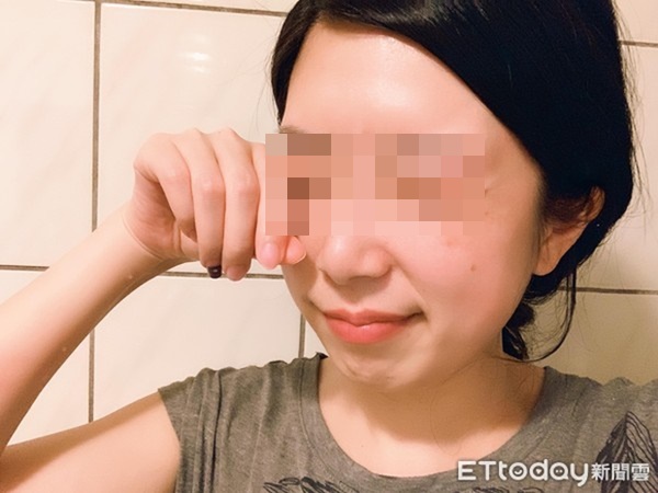 5 kiểu ngứa cho thấy bệnh tiểu đường đang ẩn nấp trong cơ thể nhưng thường bị người trẻ tuổi xem nhẹ-3