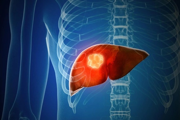 Bác sĩ Bệnh viện K nêu 5 kiểu ăn dễ ‘nuôi’ tế bào ung thư-2