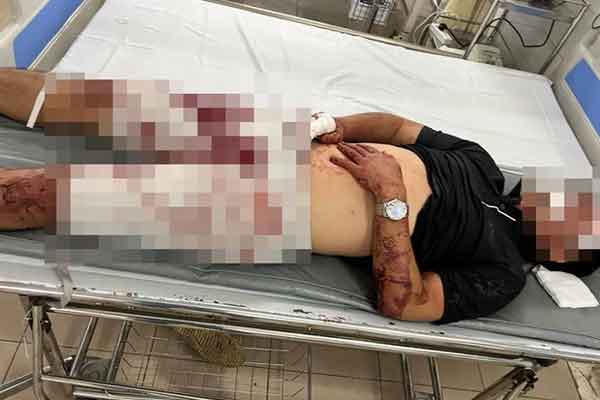 Hải Phòng: Mâu thuẫn với vợ, chồng lái ô tô lao thẳng vào công ty vợ khiến 1 người tử vong-2