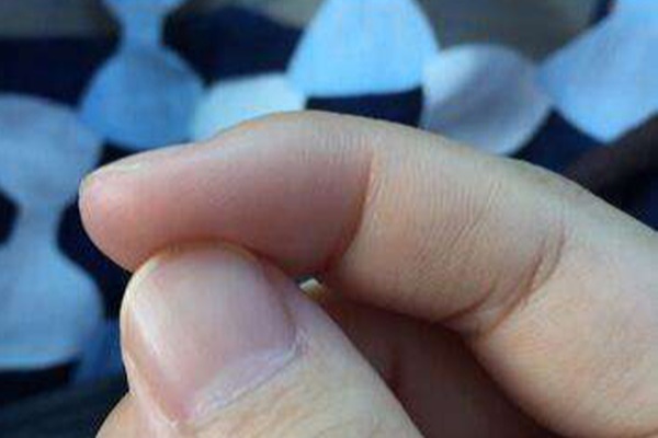 4 dấu hiệu bên ngoài tiết lộ một người đàn ông thận yếu, có thể khó làm bố-4