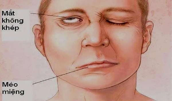 5 sai lầm thường gặp khi dùng điều hòa mùa hè, sai lầm 1 rất dễ gây đột quỵ-2
