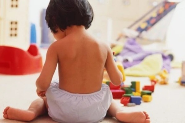 Bé gái 5 tuổi viêm vùng kín kéo dài, kháng toàn bộ kháng sinh thông thường-1