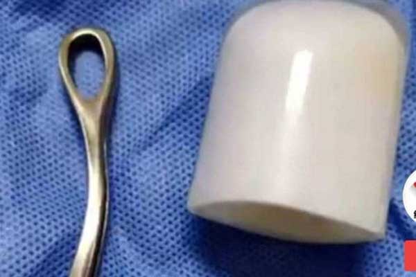 Cặp đôi tìm cảm giác lạ lúc mây mưa, bạn trai gây tai nạn cho bạn gái vì dị vật lạ-2