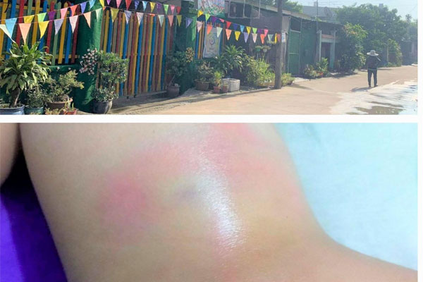 Xử lý nghiêm vụ cô giáo đánh trẻ 4 tuổi vì đi vệ sinh ra quần-1