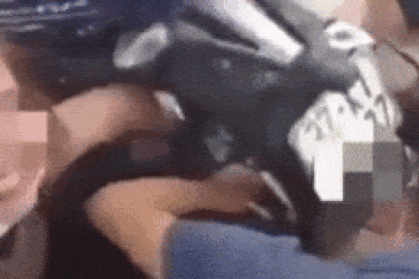 Cô gái đau đớn vật vã, tay kẹt cứng vào bánh xe máy chỉ vì một vật dụng bảo vệ ngày nắng