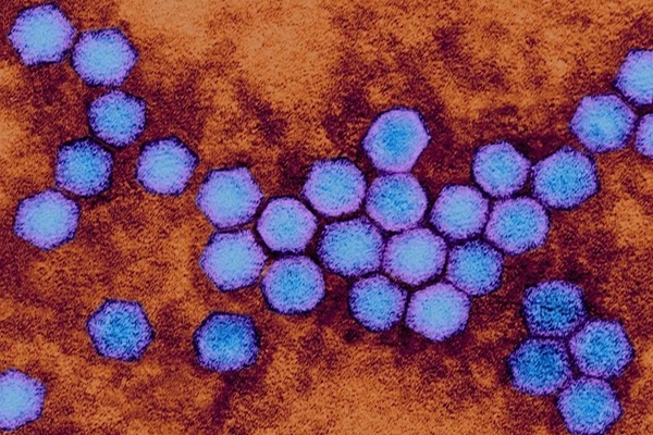 Virus bị xóa sổ gần 50 năm trước bất ngờ tái xuất ở Anh-2