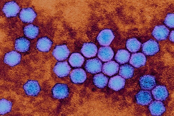 WHO đã xác định nguồn phát tán virus tuyệt tích 42 năm tái xuất trong nước thải-2