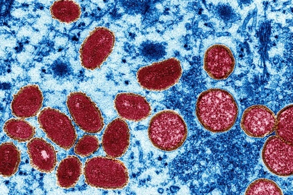 Bệnh đậu mùa khỉ đột biến với tốc độ chưa từng có-2