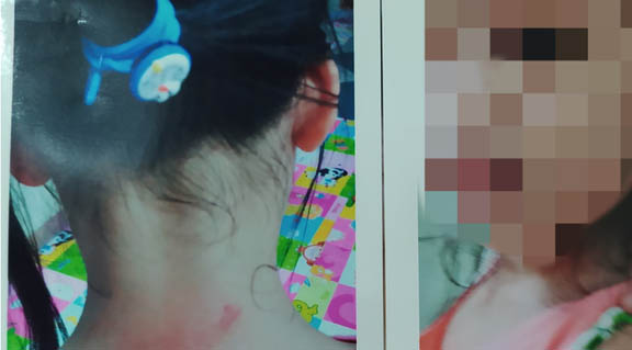 Diễn biến mới vụ ông bà nội cầu cứu vì 2 cháu gái nghi bị cha dượng bạo hành ở Hà Nội-1