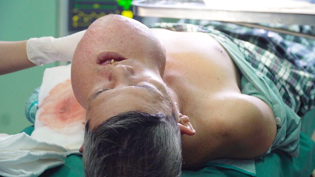 Cứu bệnh nhân bị nổ tung khối u khổng lồ-2