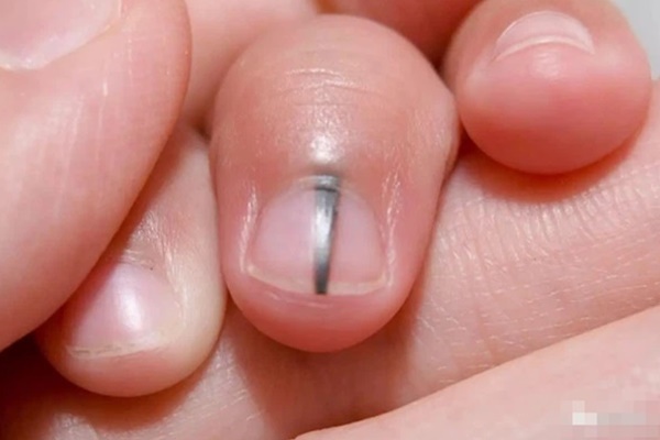 Chất kịch độc gây ung thư, tử vong trong các loại thực phẩm quen thuộc-4