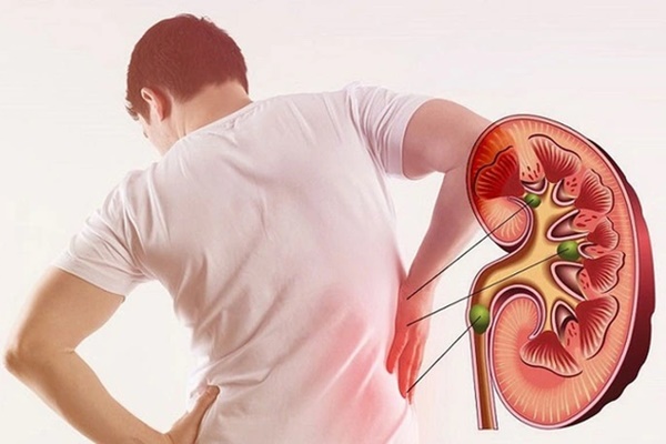 Người phụ nữ 31 tuổi bị méo miệng, mắt phải không nhắm được chỉ vì thói quen sau khi gội đầu mà nhiều người vẫn chủ quan mắc phải-3