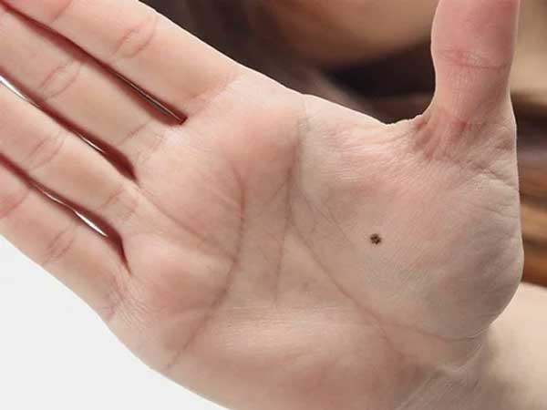 7 nốt ruồi báo hiệu điềm lành, ai sở hữu thường vượng vận đào hoa, hôn nhân viên mãn-2