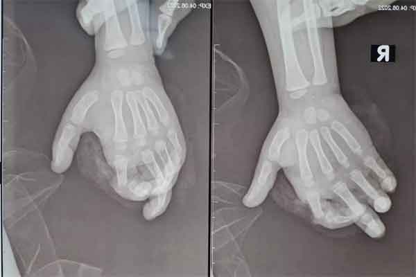 Diễn tập phòng cháy và cứu nạn trên tuyến đường sắt đô thị 2A Cát Linh- Hà Đông-6