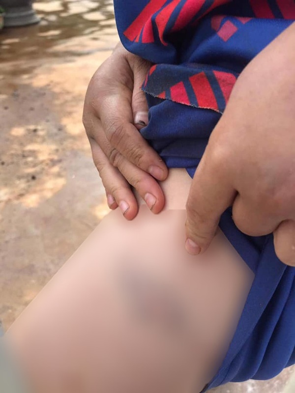 Cháu bé 9 tuổi bị bà và cha đánh đập dã man-4