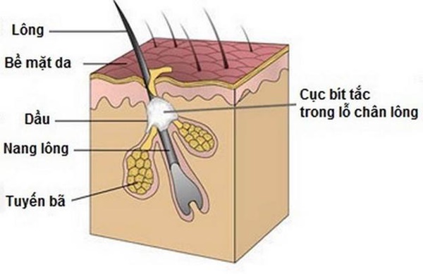 Cách làm sạch và ngăn ngừa tắc lỗ chân lông-1