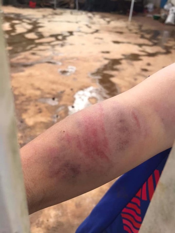 Vụ cháu bé 9 tuổi bị bà và cha đánh đập dã man: Người mẹ nói gì?-1