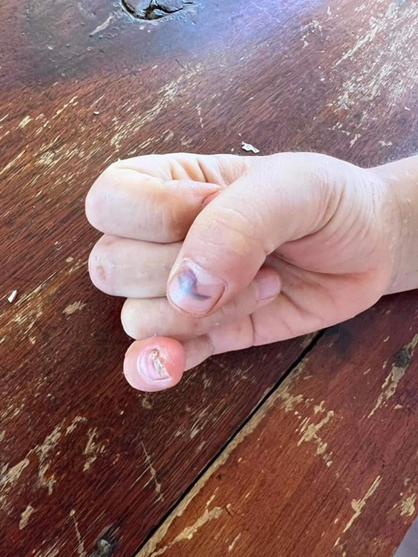 Vụ cháu bé 9 tuổi bị bà và cha đánh đập dã man: Người mẹ nói gì?-2