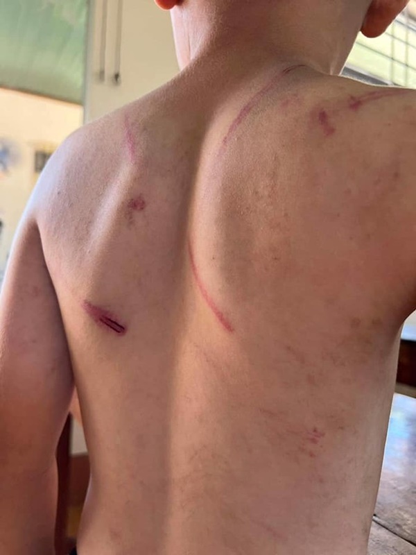 Vụ cháu bé 9 tuổi bị bà và cha đánh đập dã man: Người mẹ nói gì?-3