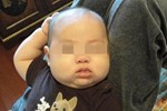 Bé trai 2 tuổi thường xuyên gãi đầu, đến bệnh viện, bác sĩ nói may mà phát hiện sớm