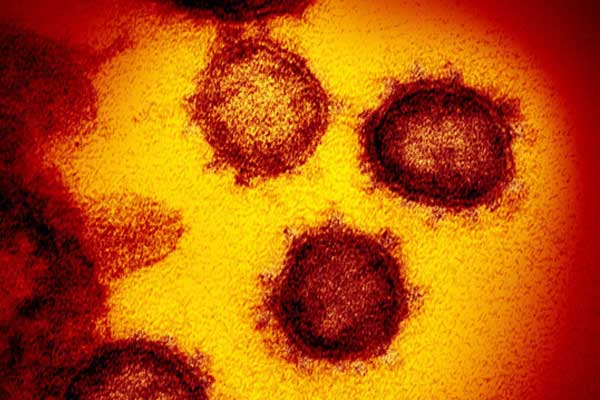 BA.5 xuất hiện, số ca mắc Covid-19 diễn biến nặng tăng nhẹ-3