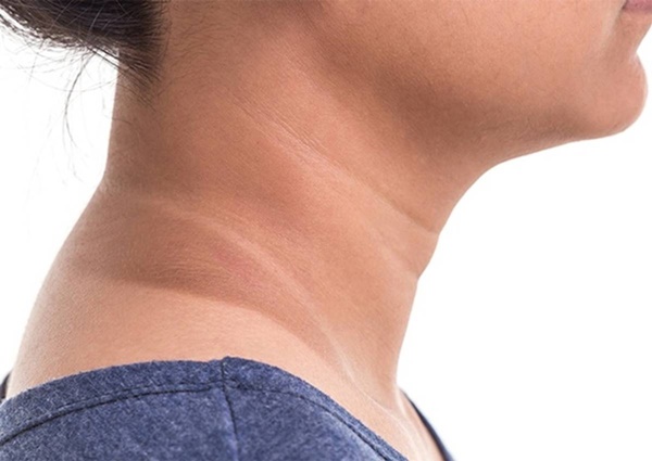 10 dấu hiệu trên da cảnh báo bệnh tiểu đường-2