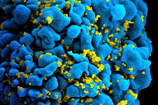 Phương pháp mới có thể chữa khỏi AIDS chỉ bằng một mũi tiêm-1