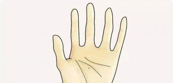 Nốt ruồi ở các vị trí khác nhau có ý nghĩa như thế nào?-6