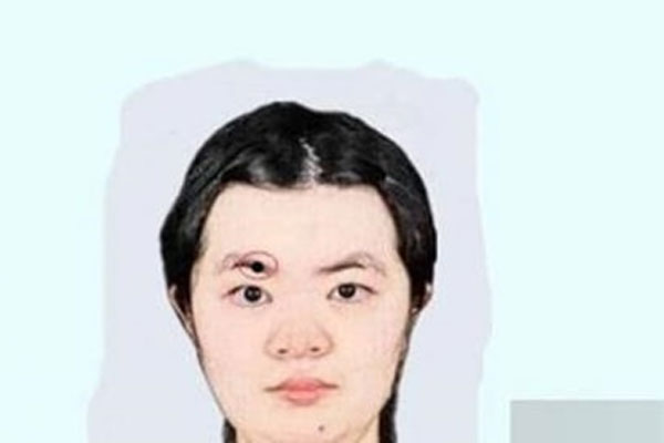 4 nốt ruồi vơ hết tài lộc trong thiên hạ ai có sung túc suốt đời, 1 vị trí tán lộc nghèo khổ-3