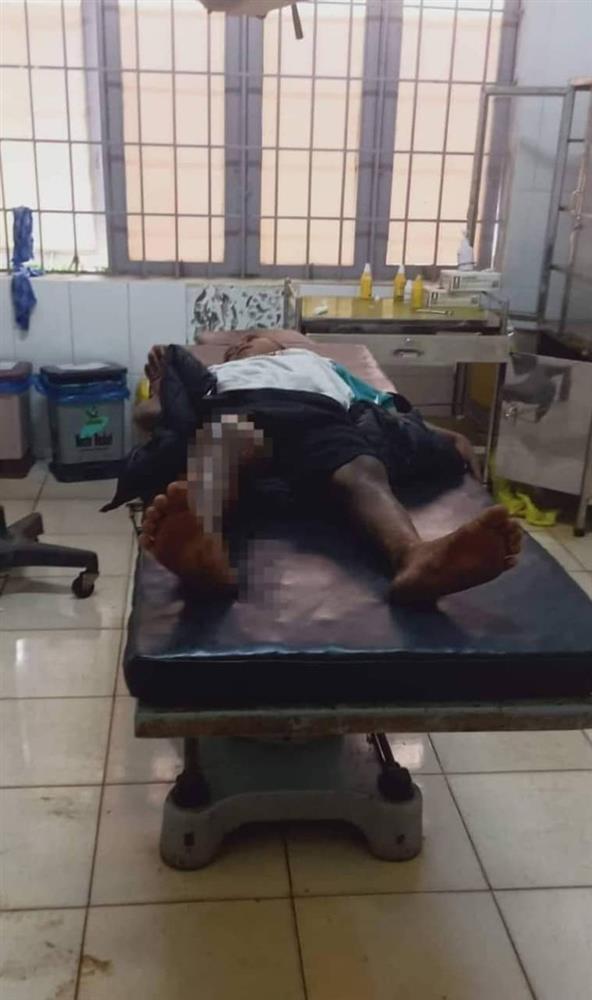 Cháu bé 8 tuổi bị tẩm xăng đốt vì không chịu đi trộm cắp-1