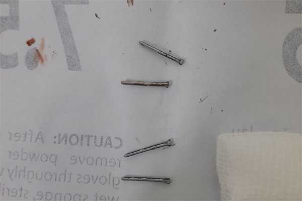 Lời kể của thanh niên được chuộc với giá 2.600 USD từ Campuchia: Nhiều lần tìm cơ hội bỏ trốn nhưng vô vọng-8