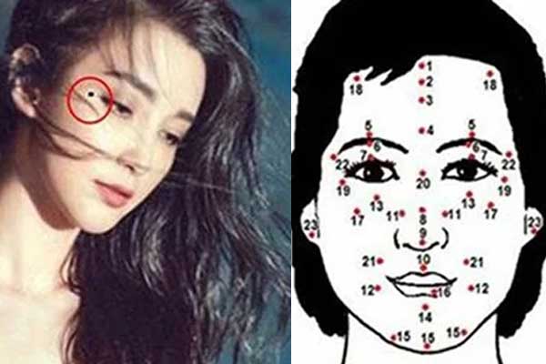 7 nốt ruồi vượng tướng tu 10 đời mới có, đừng dại tẩy đi kẻo tài lộc bay biến hết, nghèo suốt kiếp-1