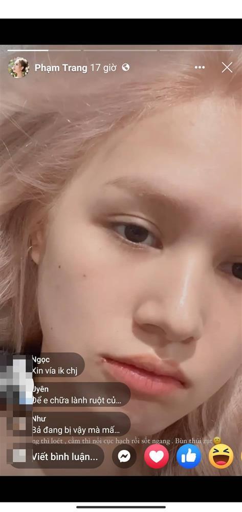 Giật mình nhìn Xoài Non lộ mặt mụn, mắt quầng thâm-2