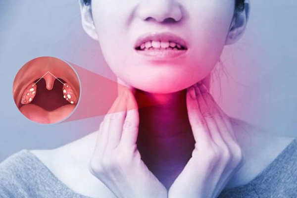 Ngứa họng gây ho, đừng chủ quan vì rất có thể bạn đang mắc bệnh nguy hiểm này-2