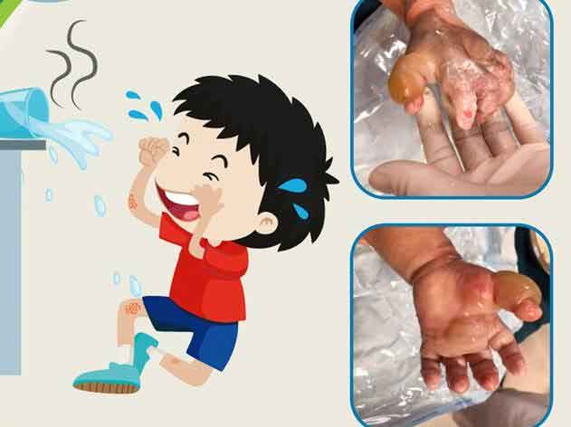 Mẹ hối hận vì đưa con đi đắp thuốc trị bỏng-1