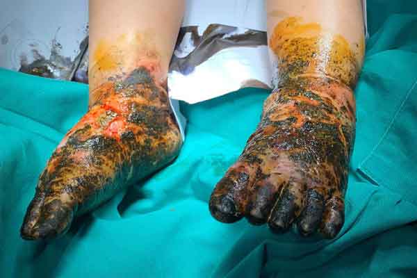 Bị chuột rút khi đang ngủ: Tín hiệu ngầm của nhiều bệnh nguy hiểm cần chú ý-4