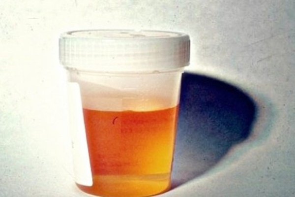 Nước tiểu trẻ sơ sinh màu vàng, có mùi khai có nguy hiểm không?-3