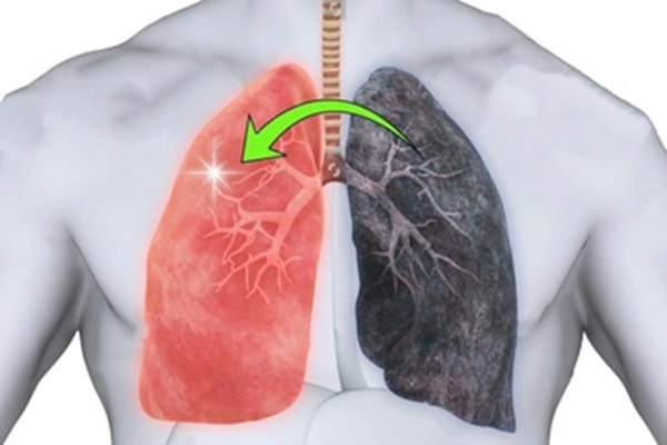 Lý do nên ăn dưa hấu-1