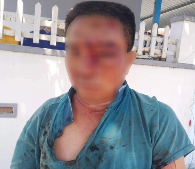 Tài xế, phụ xe khách đánh người đàn ông dã man vì mâu thuẫn gửi hàng-1