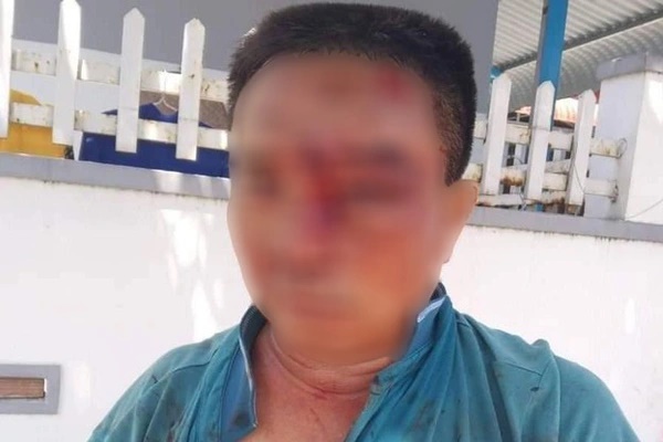 Công an làm rõ vụ người phụ nữ múa dao trên phố ở Đà Lạt-2