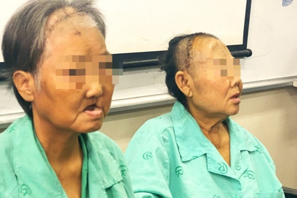 Lý do nhiều quốc gia lo sợ BA.5-3