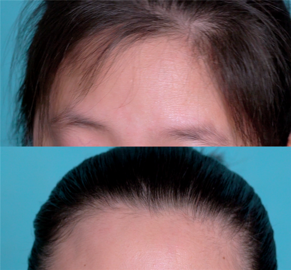 Cắt một góc&nbsp;lông bàn chải đánh răng bỏ vào bếp, ai ngờ cả nhà lao vào sử dụng-10